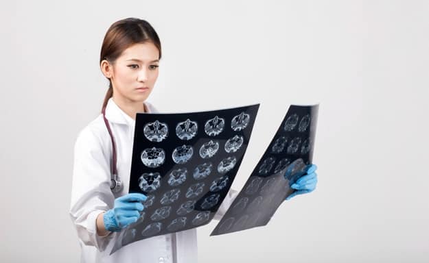 New Stem Cell Model Can Improve Vision Loss Research | The Stem Cell Model of Macular Degeneration Is Finally Created