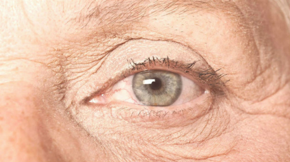 Feature | Macular Degeneration Treatments: Natural Ways To Reverse This Eye Condition