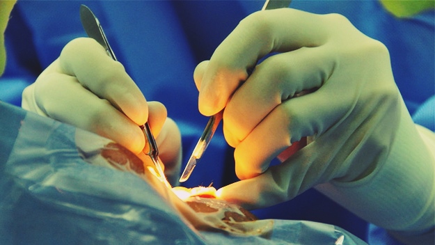 The Downsides of Cataracts Surgery | Negatives of Cataracts Surgery