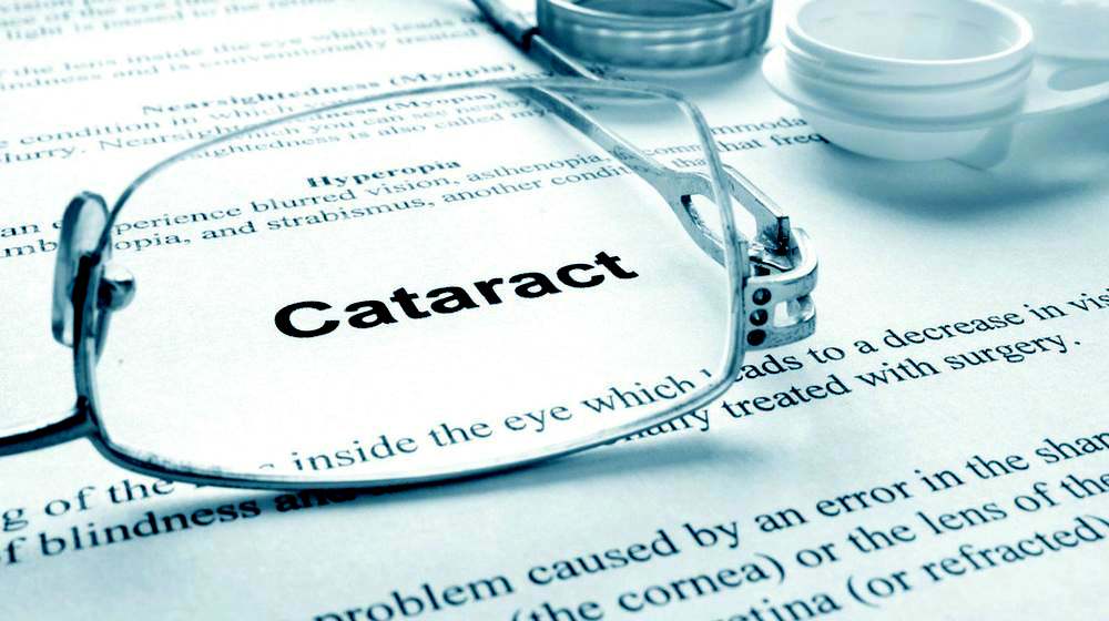 Cataracts Definition | What Are Cataracts