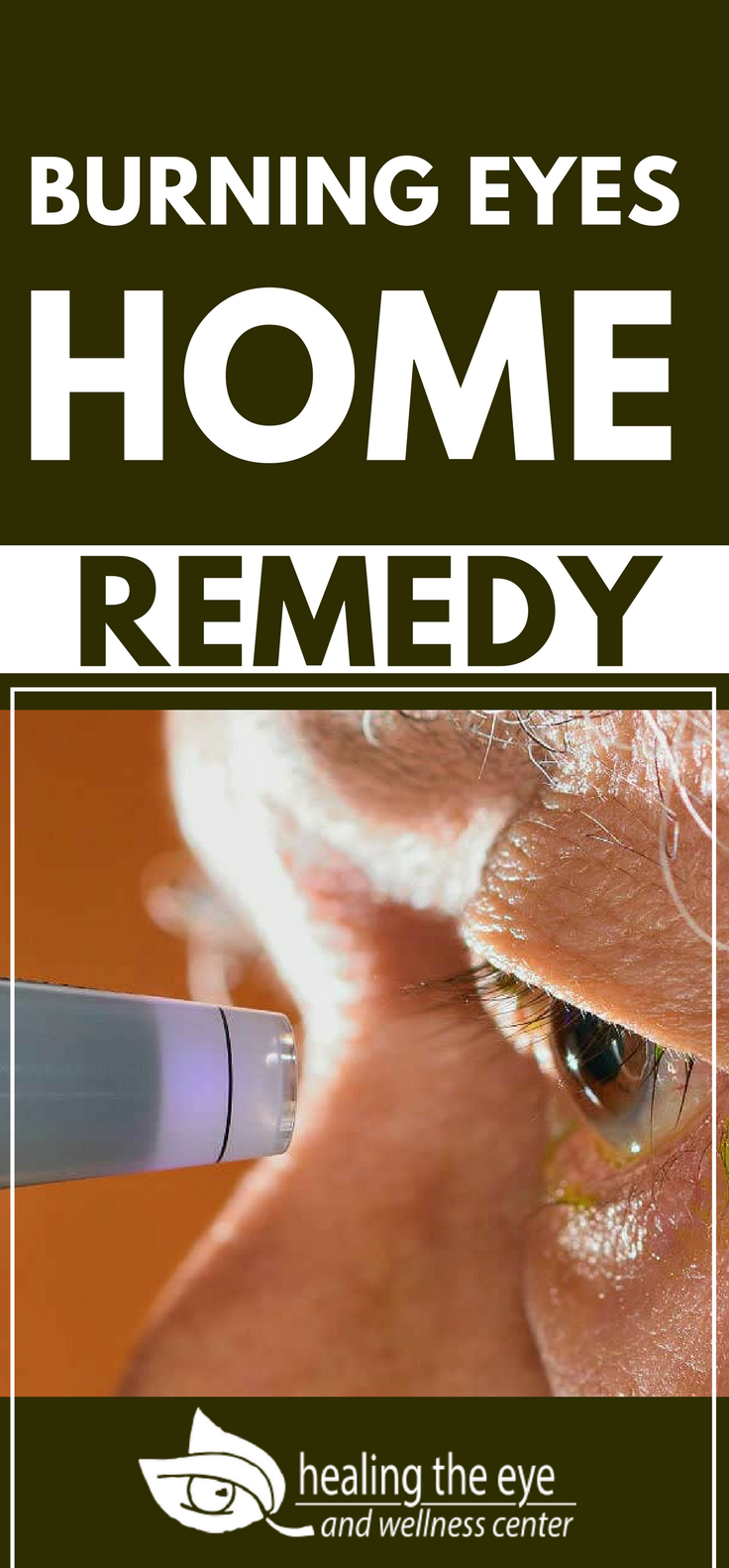 Burning Eyes Home Remedy | Natural Remedies