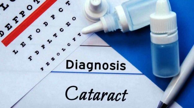 7 Symptoms of Cataracts | Cataract Awareness Month | Everything You Need To Know