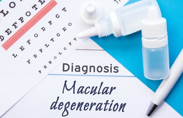 Symptoms of macular degeneration