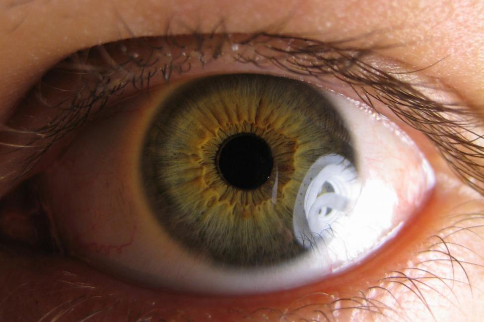 Must-Know Facts About Glaucoma | Symptoms | Treatments | Cure