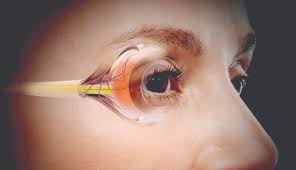 Symptoms Signal An eye Health Problem