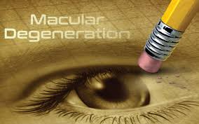 Ultraviolet Light a Cause of Macular Degeneration