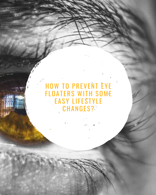 Prevent Eye Floaters With Some Easy Lifestyle Changes?