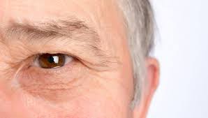 Eye Problems In Aging Adults